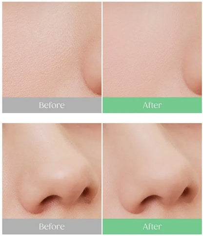 PERIPERA.  Oil Capture Setting Pact.